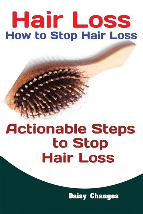 Hair Loss: How to Stop Hair Loss Actionable Steps to Stop Hair Loss (Hair Loss Cure, Hair Care, Natural Hair Loss Cures) (Paperback)