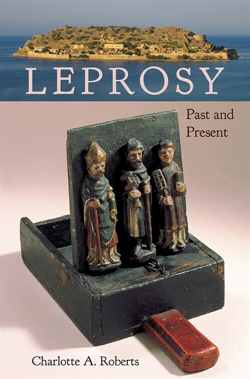 Leprosy: Past and Present (Hardcover)