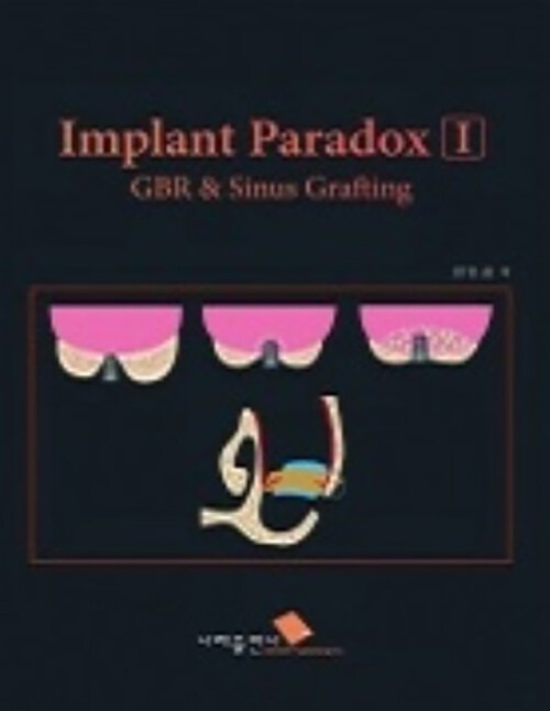 Implant Paradox I GBR & Sinus Grafting