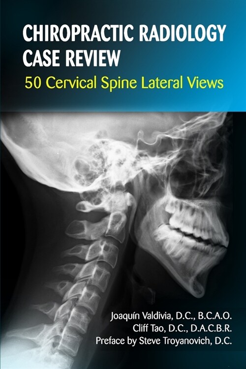 Chiropractic Radiology Case Review: 50 Cervical Spine Lateral Views (Paperback)