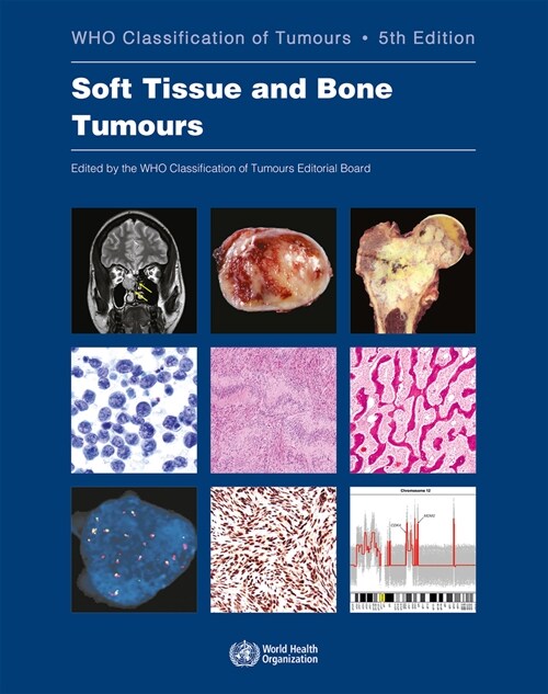 Soft Tissue and Bone Tumours: Who Classification of Tumours (Paperback, 5)