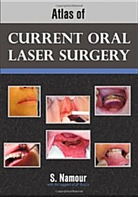 Atlas of Current Oral Laser Surgery (Paperback)