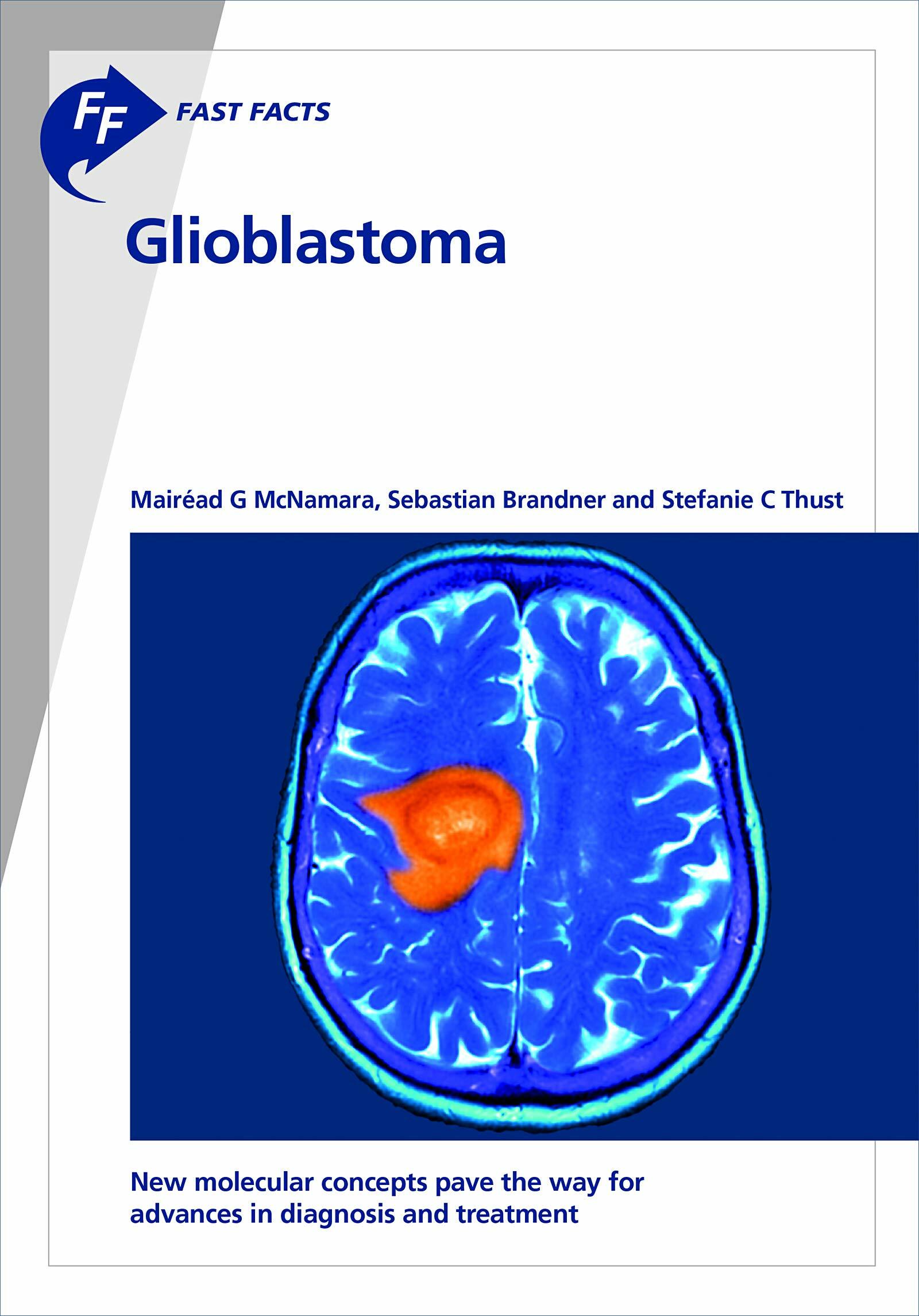 Fast Facts: Glioblastoma (Paperback)