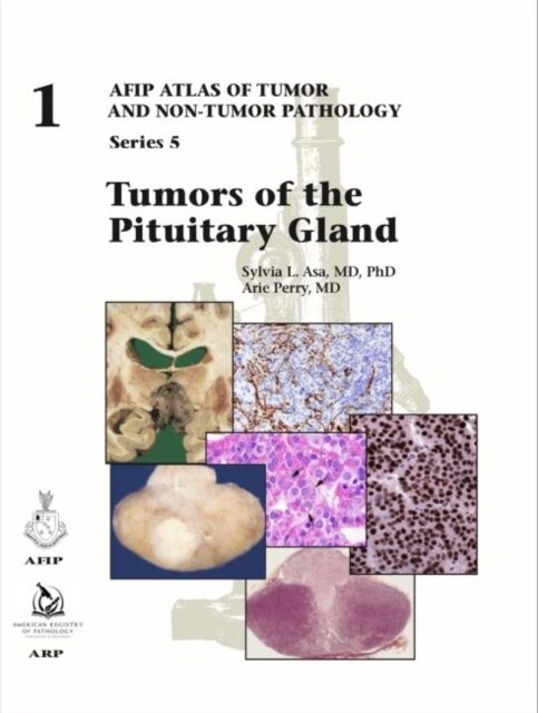 Tumors of the Pituitary Gland (Hardcover)