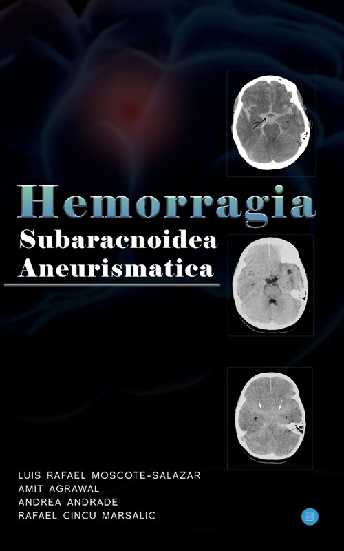 Hemorragia Subaracnoidea Aneurismatica (Paperback)