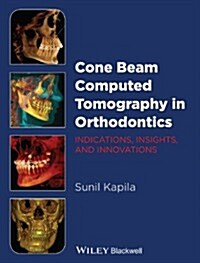 Cone Beam Computed Tomography in Orthodontics: Indications, Insights, and Innovations (Hardcover)