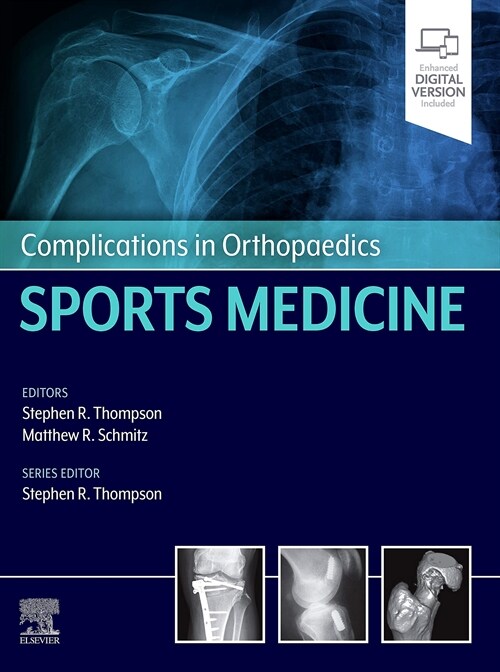 Complications in Orthopaedics: Sports Medicine (Hardcover)
