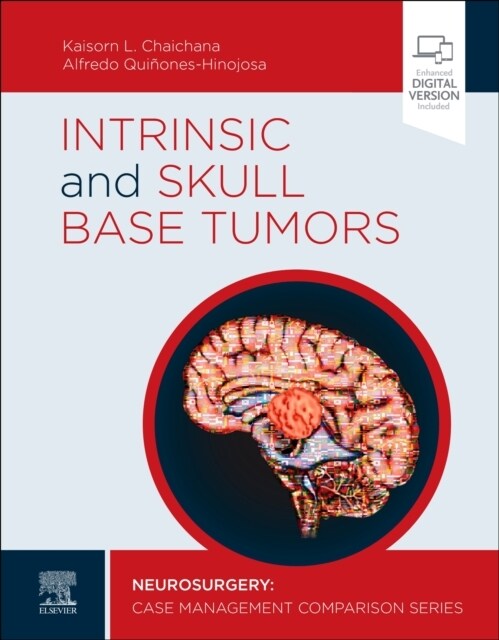 Intrinsic and Skull Base Tumors: Neurosurgery: Case Management Comparison Series (Hardcover)