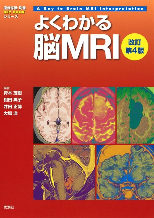 よくわかる腦MRI