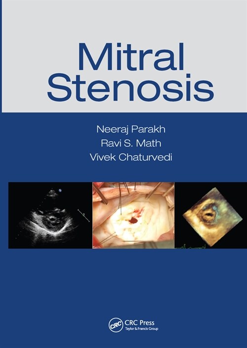 Mitral Stenosis (Paperback, 1)