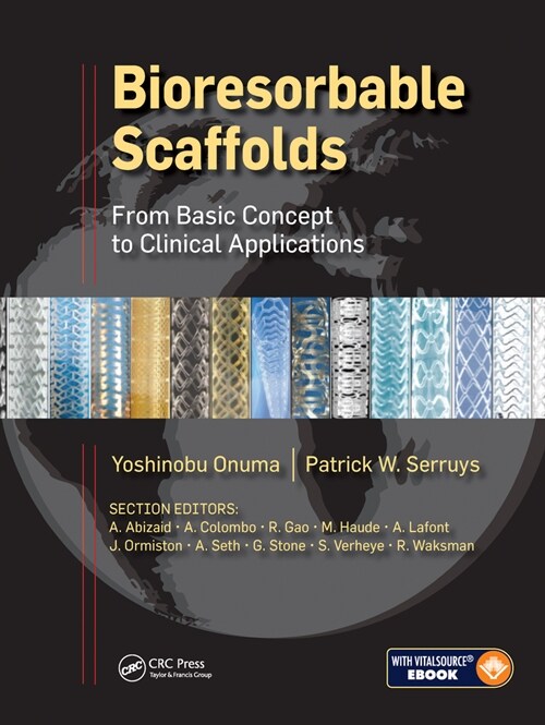 Bioresorbable Scaffolds : From Basic Concept to Clinical Applications (Paperback)