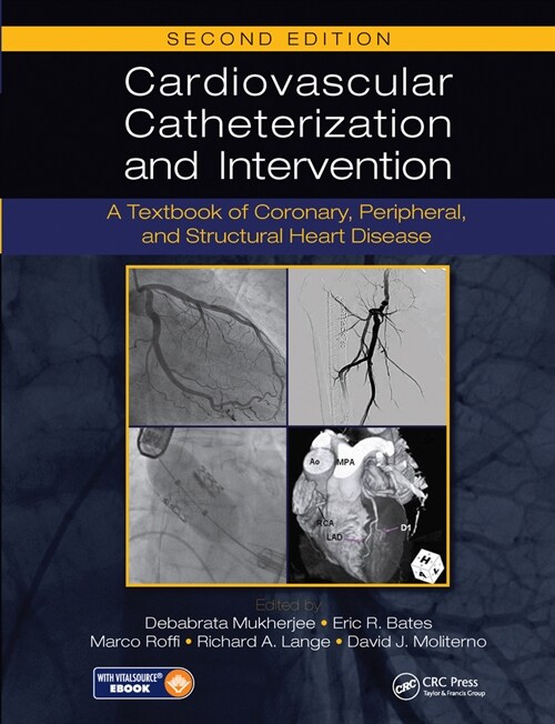 Cardiovascular Catheterization and Intervention : A Textbook of Coronary, Peripheral, and Structural Heart Disease, Second Edition (Paperback, 2 ed)