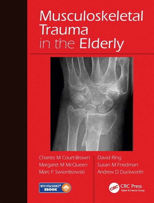 Musculoskeletal Trauma in the Elderly (Paperback, 1)