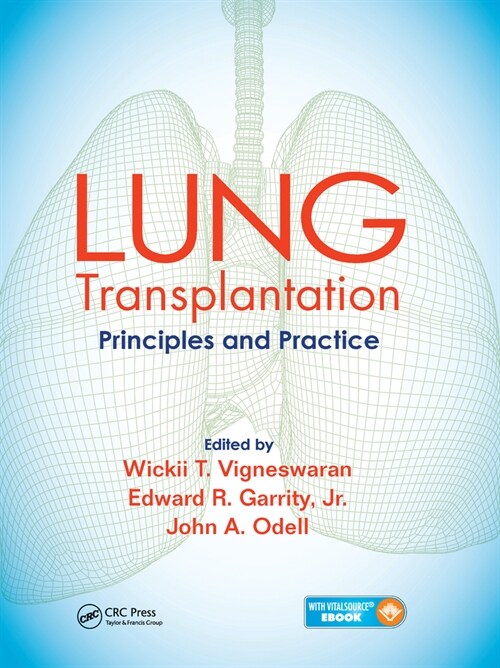 Lung Transplantation : Principles and Practice (Paperback)