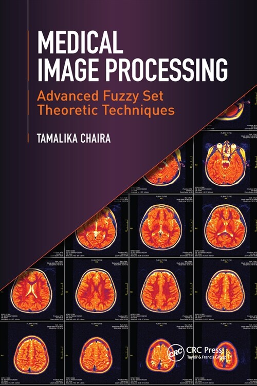 Medical Image Processing : Advanced Fuzzy Set Theoretic Techniques (Paperback)