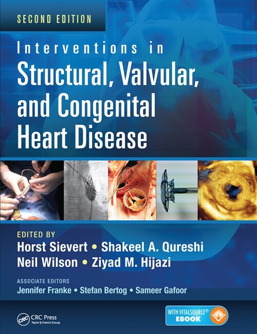 Interventions in Structural, Valvular and Congenital Heart Disease (Paperback, 2 ed)