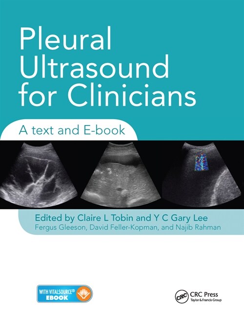 Pleural Ultrasound for Clinicians : A Text and E-book (Paperback)