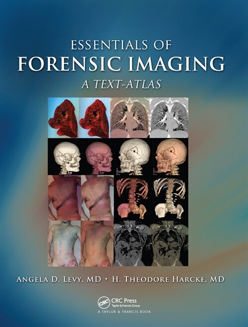 Essentials of Forensic Imaging : A Text-Atlas (Paperback)
