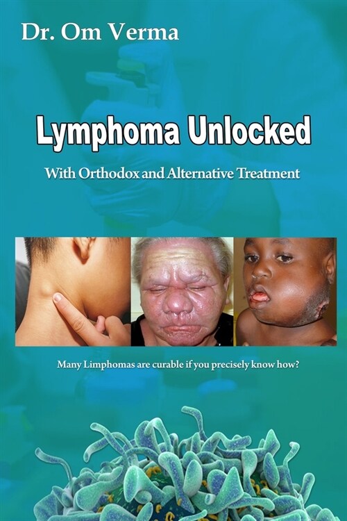 Lymphoma Unlocked: With Orthodox and Alternative Treatment (Paperback)