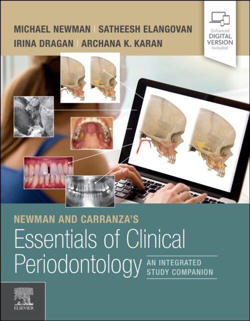 Newman and Carranzas Essentials of Clinical Periodontology: An Integrated Study Companion (Paperback)