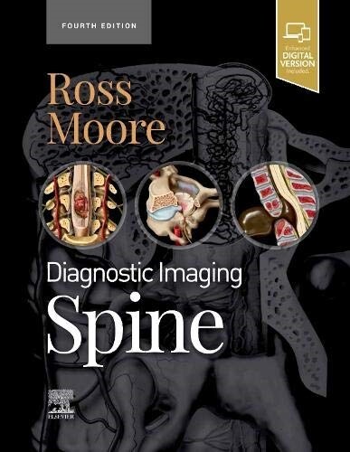 Diagnostic Imaging: Spine (Hardcover, 4)