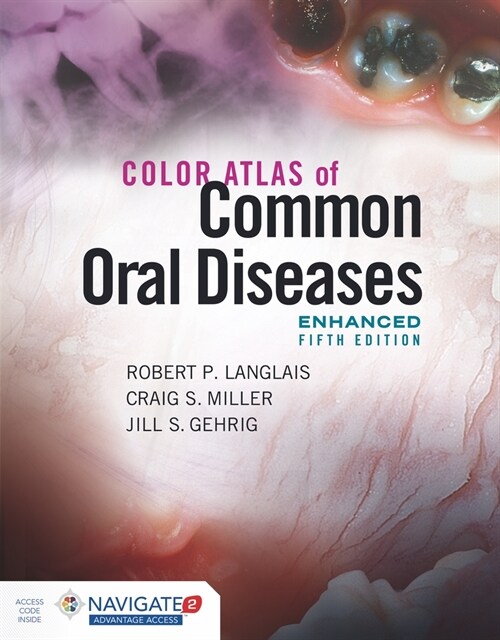 Color Atlas of Common Oral Diseases, Enhanced Edition (Paperback, 5)