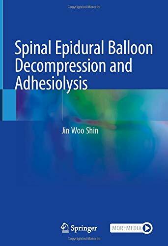 Spinal Epidural Balloon Decompression and Adhesiolysis (Hardcover)