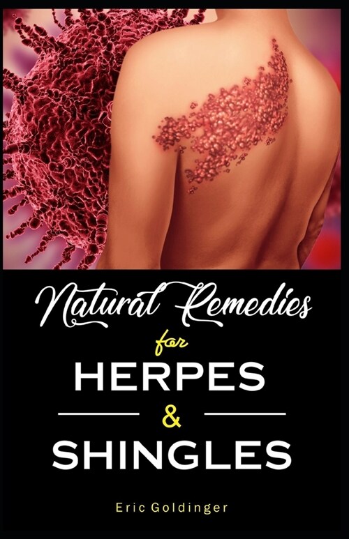 Natural Remedies For HERPES & SHINGLES: The Complete Guide (Paperback)