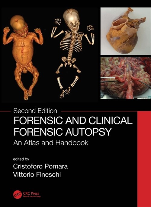 Forensic and Clinical Forensic Autopsy : An Atlas and Handbook (Hardcover, 2 ed)