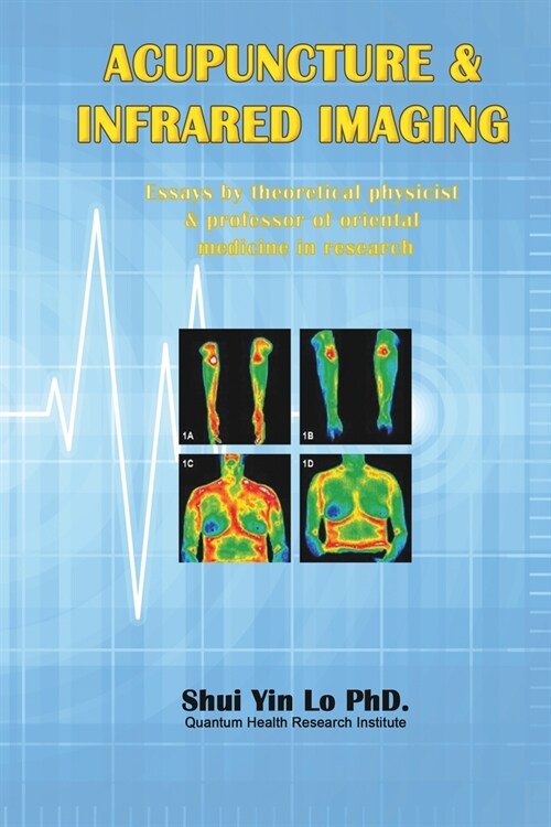 Acupuncture and Infrared Imaging: Essays by theoretical physicist & professor of oriental medicine in research (Paperback)