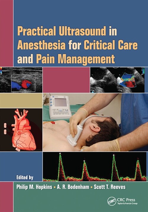 Practical Ultrasound in Anesthesia for Critical Care and Pain Management (Paperback, 1)
