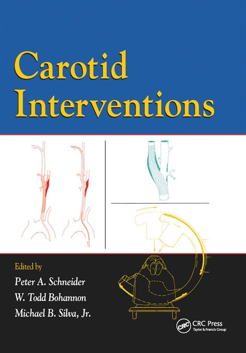Carotid Interventions (Paperback, 1)