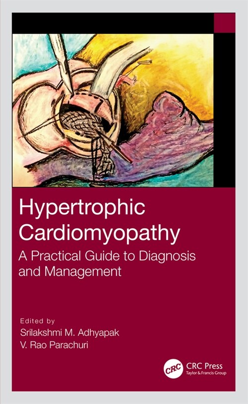 Hypertrophic Cardiomyopathy : A Practical Guide to Diagnosis and Management (Hardcover)