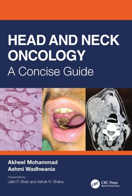 Head and Neck Oncology : A Concise Guide (Hardcover)