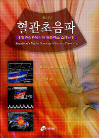 혈관초음파 : 혈관질환에서의 듀플렉스 스캐닝