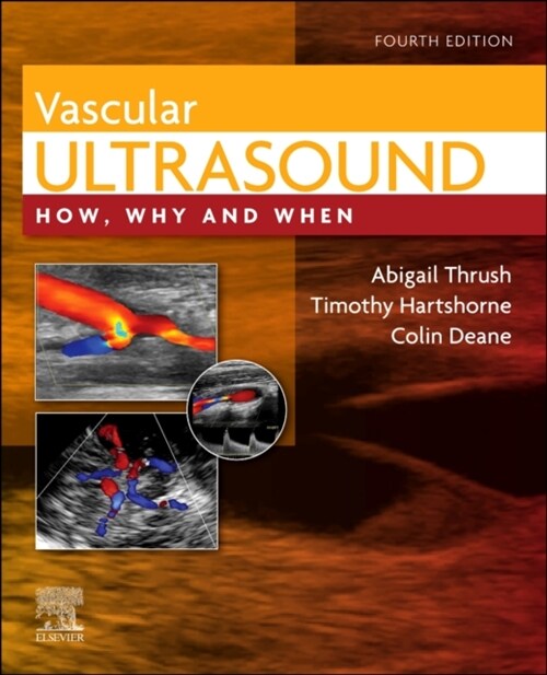 Vascular Ultrasound : How, Why and When (Hardcover, 4 ed)