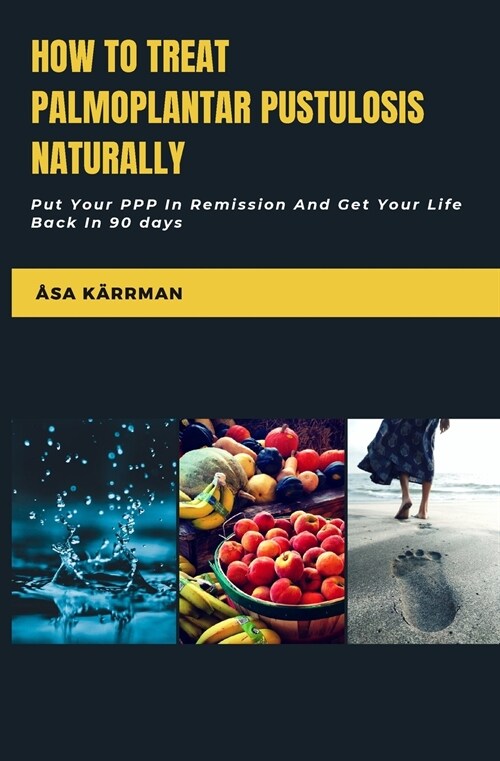 How To Treat Palmoplantar Pustulosis Naturally: Put Your PPP In Remission And Get Your Life Back In 90 Days (Paperback, 2)