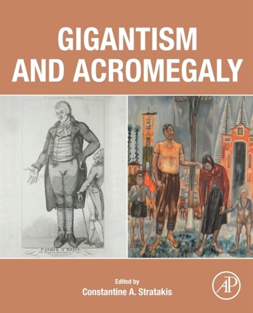 Gigantism and Acromegaly (Paperback)