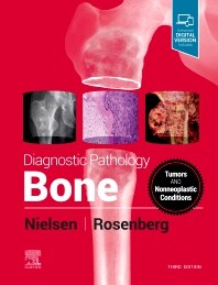 Diagnostic Pathology: Bone (Hardcover, 3)