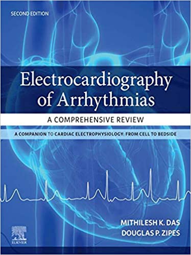 Electrocardiography of Arrhythmias: A Comprehensive Review (Paperback, 2)