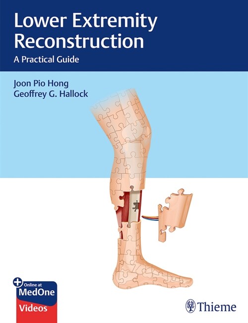 Lower Extremity Reconstruction: A Practical Guide (Hardcover)