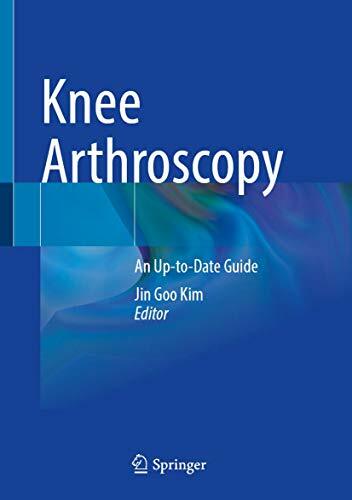 Knee Arthroscopy: An Up-To-Date Guide (Hardcover, 2021)