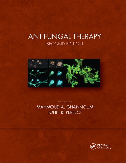 Antifungal Therapy, Second Edition (Paperback, 2 ed)