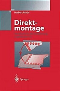 Direktmontage: Handbuch ?er Die Verarbeitung Ungeh?ster ICS (Paperback, Softcover Repri)