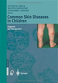 Common Skin Diseases in Children: Diagnosis and Management (Paperback, Softcover Repri)