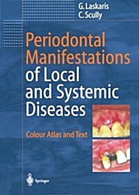 Periodontal Manifestations of Local and Systemic Diseases: Colour Atlas and Text (Paperback, Softcover Repri)
