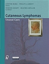 Cutaneous Lymphomas: Unusual Cases (Paperback, 2001)