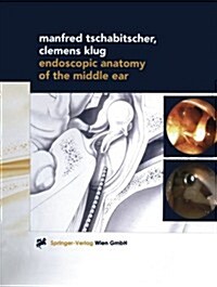 Endoscopic Anatomy of the Middle Ear (Paperback)