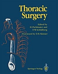 Thoracic Surgery: Surgical Procedures on the Chest and Thoracic Cavity (Paperback, Softcover Repri)