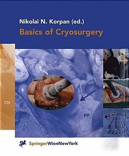 Basics of Cryosurgery (Paperback, Softcover Repri)